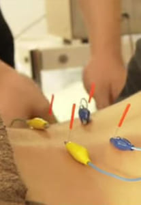 あおやま鍼灸整骨院のパルス治療
